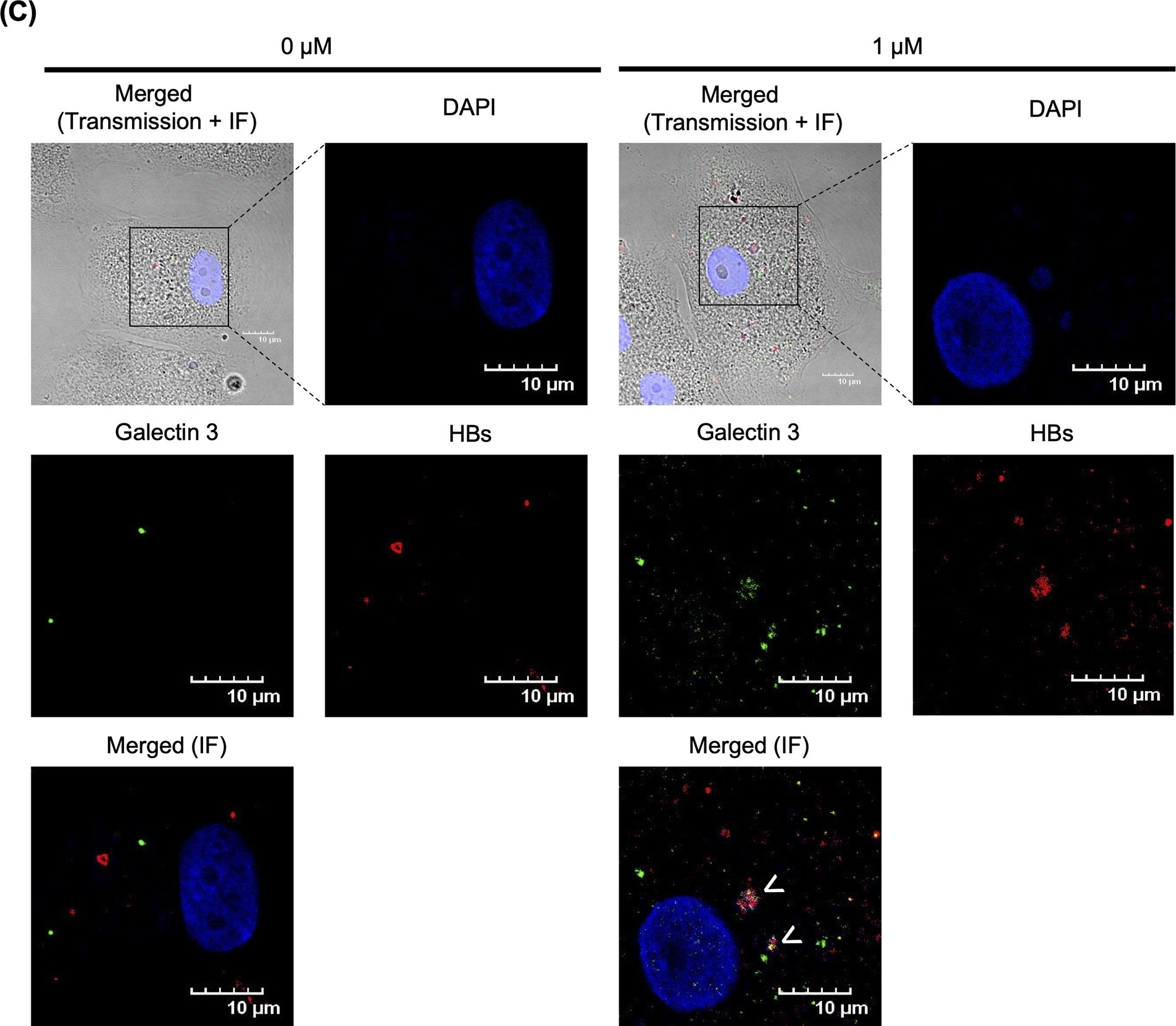Fig.4.C showing Immunocytochemistry-immunofluorescence in a Homo sapiens (Human) sample from the publication: Auranofin, identified by FDA-approved drug library screening, inhibits HBs antigen secretion via lysosomal damage.