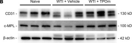 専用　cd31枚 CD31/PECAM-1 Antibody (JC/70A) - BSA Free (NB600-562) by