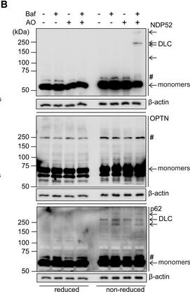 NDP52 acts as a redox sensor in PINK1/Parkin-mediated mitophagy.