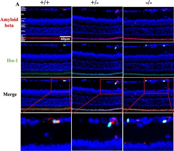 Fig.5.A showing Immunohistochemistry-immunofluorescence in a Mus musculus (House mouse) sample from the publication: Klotho null mutation leads to retinal degeneration characterized by functional impairment, gliosis, and deposition of amyloid-beta and hyperphosphorylated tau proteins.