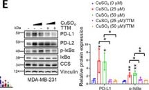 Fig.1.E showing Western Blotting from the publication: Disruption of NF-κB-Mediated Copper Homeostasis Sensitizes Breast Cancer to Cuproptosis.