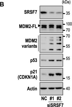 Fig.3.B showing Western Blotting from the publication: SRSF7 downregulation induces cellular senescence through generation of MDM2 variants.