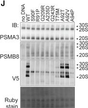 Fig.4.J showing Western Blotting in a Homo sapiens (Human) sample from the publication: Monoallelic PSMB8 variants cause PRAAS with immunodeficiency through impaired immunoproteasome assembly.