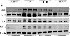 Fig.6.G showing Western Blotting from the publication: Inhalable ROS-Responsive Nanospray Activates PPAR-γ to Restore Macrophage Mitochondrial Homeostasis and Attenuate Radiation-Induced Lung Injury.