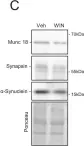 Fig.4.C showing Western Blotting from the publication: CB1-receptor-mediated inhibitory LTD triggers presynaptic remodeling via protein synthesis and ubiquitination.