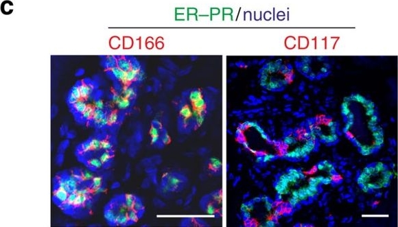 Fig.1.C showing Immunohistochemistry-immunofluorescence in a Homo sapiens (Human) sample from the publication: Propagation of oestrogen receptor-positive and oestrogen-responsive normal human breast cells in culture.