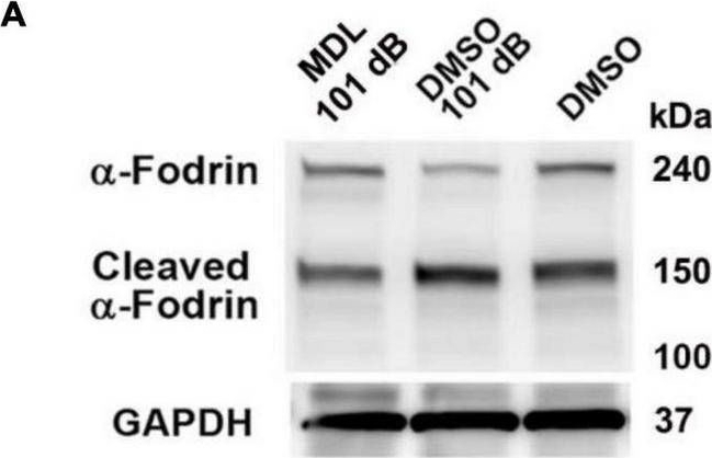 Fig.5.A showing Western Blotting in a Mus musculus (House mouse) sample from the publication: Prevention of noise-induced hearing loss by calpain inhibitor MDL-28170 is associated with upregulation of PI3K/Akt survival signaling pathway.
