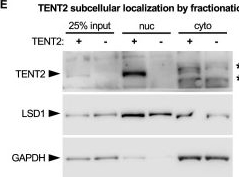 Fig.11.E showing Western Blotting from the publication: Widespread mono- and oligoadenylation direct small noncoding RNA maturation versus degradation fates.