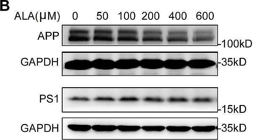 Fig.3.B showing Western Blotting in a Homo sapiens (Human) sample from the publication: Alpha-lipoic acid alleviates cognitive deficits in transgenic APP23/PS45 mice through a mitophagy-mediated increase in ADAM10 α-secretase cleavage of APP.