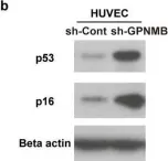 Fig.1.B showing Western Blotting from the publication: Glycoprotein nonmetastatic melanoma protein B regulates lysosomal integrity and lifespan of senescent cells.
