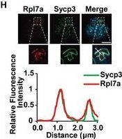 Fig.2.H showing Immunocytochemistry-immunofluorescence in a Mus musculus (House mouse) sample from the publication: Pre-rRNA Facilitates TopBP1-Mediated DNA Double-Strand Break Response.