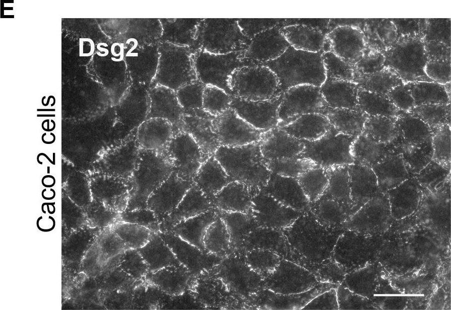 Desmoglein 2 is less important than desmoglein 3 for keratinocyte cohesion.