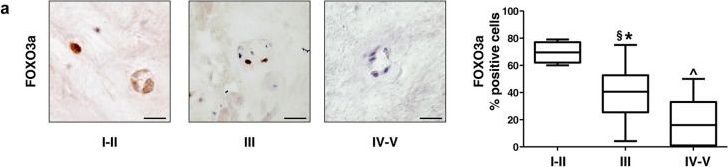 Fig.2.A showing Immunohistochemistry in a Homo sapiens (Human) sample from the publication: Immunohistochemical analysis to detect a molecular signature in intervertebral disc degeneration.