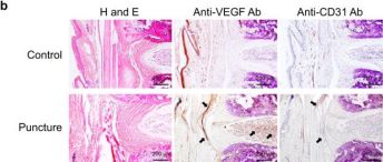 CD31 Antibody (PECAM-1) (D8V9E) XP® Rabbit mAb | Cell Signaling