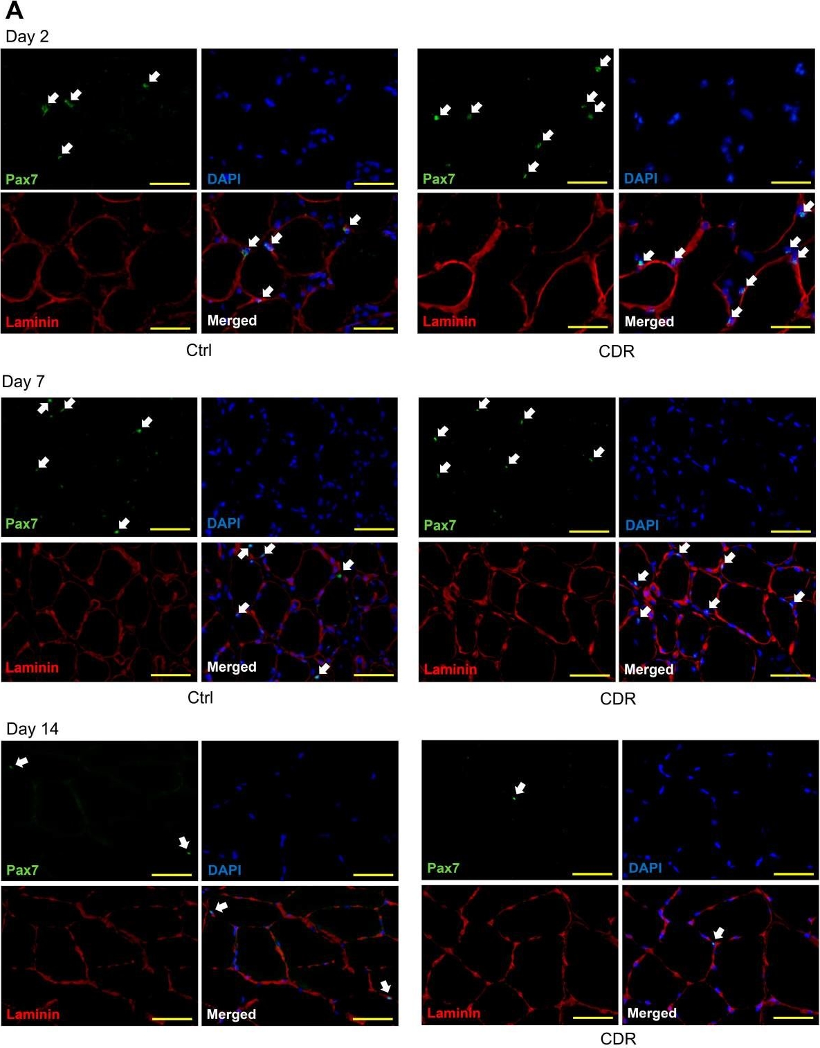Fig.3.A showing Immunohistochemistry-immunofluorescence in a Rattus norvegicus (Rat) sample from the publication: Traditional Chinese Medicine for Topical Treatment of Skeletal Muscle Injury.