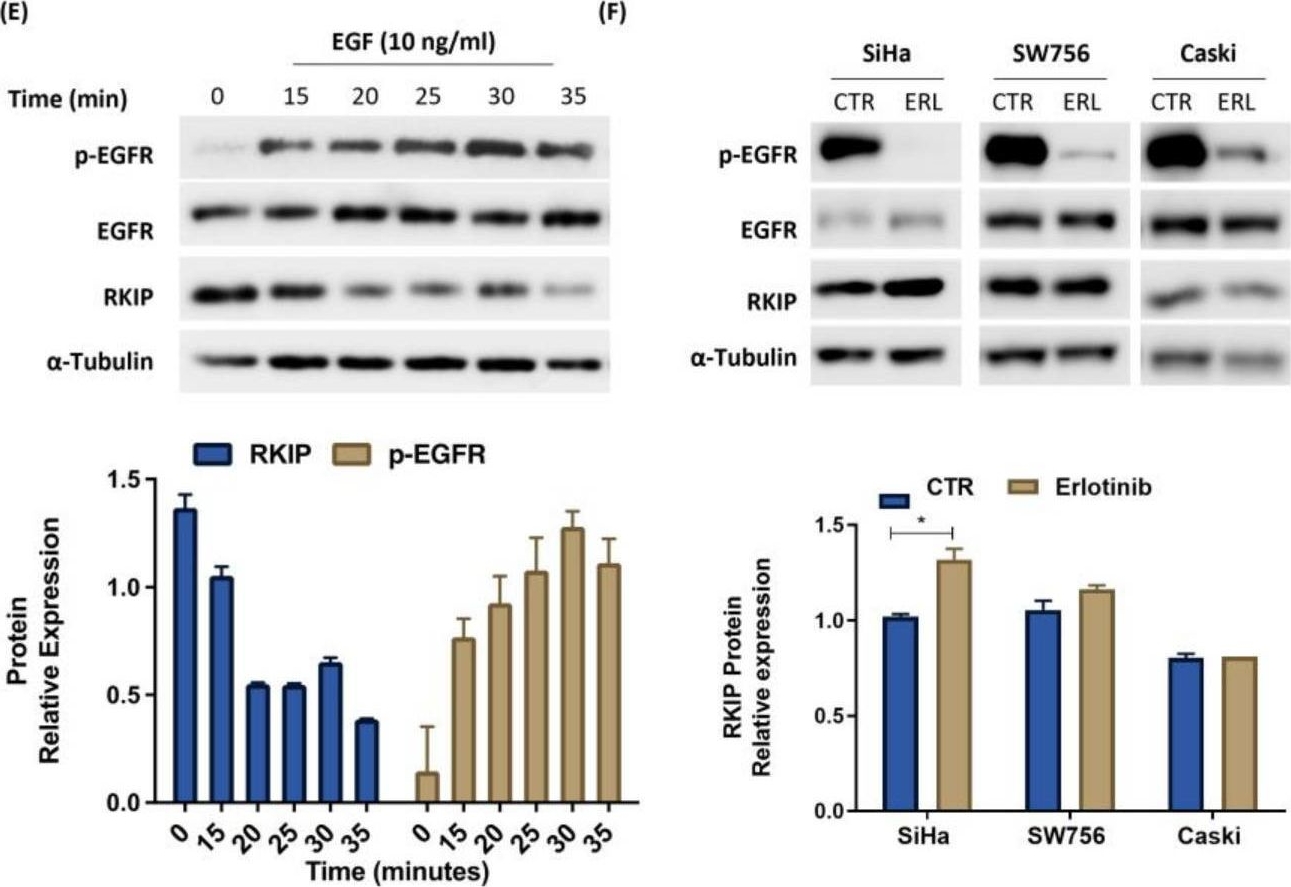 Fig.3.E showing Western Blotting in a Homo sapiens (Human) sample from the publication: Unveiling the RKIP and EGFR Inverse Relationship in Solid Tumors: A Case Study in Cervical Cancer.