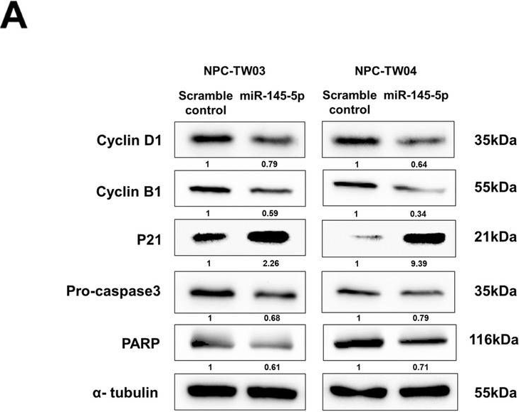 Fig.5.A showing Western Blotting in a Homo sapiens (Human) sample from the publication: MicroRNA-145-5p modulates Krüppel-like factor 5 and inhibits cell proliferation, migration, and invasion in nasopharyngeal carcinoma.