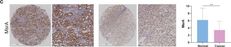 Fig.9.C showing Immunohistochemistry from the publication: A reactive oxygen species-related signature to predict prognosis and aid immunotherapy in clear cell renal cell carcinoma.
