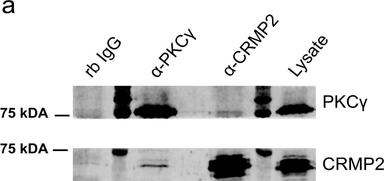 Fig.1.A showing Western Blotting in a Mus musculus (House mouse) sample from the publication: PKCγ-Mediated Phosphorylation of CRMP2 Regulates Dendritic Outgrowth in Cerebellar Purkinje Cells.