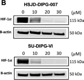Fig.2.B showing Western Blotting from the publication: Atovaquone Targets Mitochondrial Metabolism and Enhances Radiosensitivity of Diffuse Intrinsic Pontine Glioma.