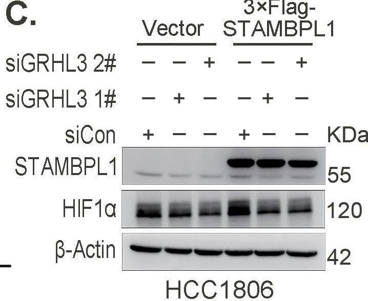 Fig.4.C showing Western Blotting in a Homo sapiens (Human) sample from the publication: STAMBPL1 activates the GRHL3/HIF1A/VEGFA axis through interaction with FOXO1 to promote angiogenesis in triple-negative breast cancer.