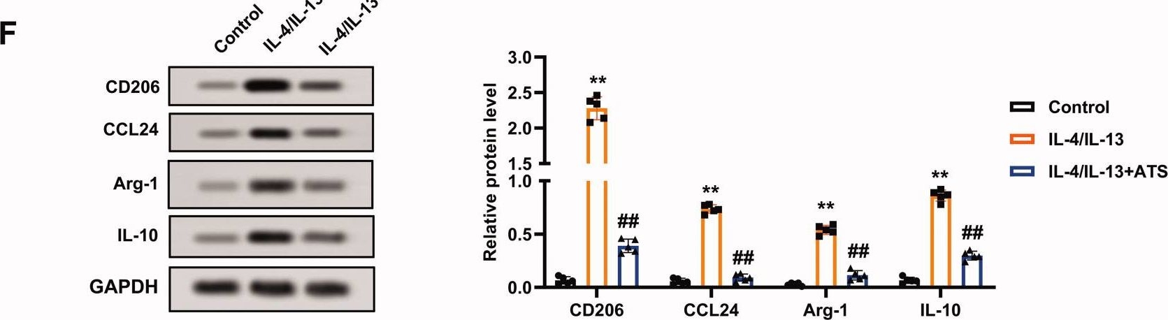 Fig.1.F showing Western Blotting from the publication: Asiaticoside reverses M2 phenotype macrophage polarization-evoked osteosarcoma cell malignant behaviour by TRAF6/NF-κB inhibition.