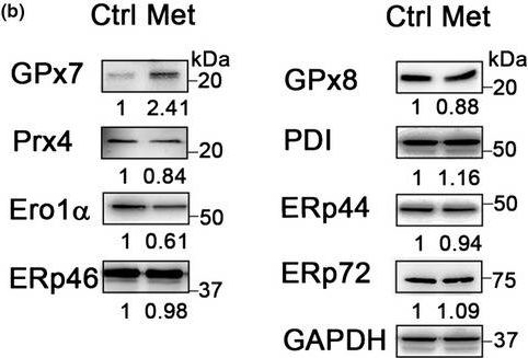 Fig.2.B showing Western Blotting from the publication: Metformin alleviates human cellular aging by upregulating the endoplasmic reticulum glutathione peroxidase 7.