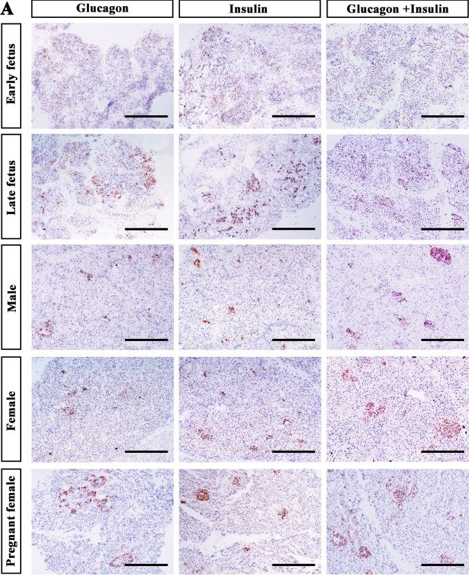 Fig.5.A showing Immunohistochemistry from the publication: Identification of insulin and glucagon genes in the finless porpoise and the developmental distribution of their producing endocrine cells.