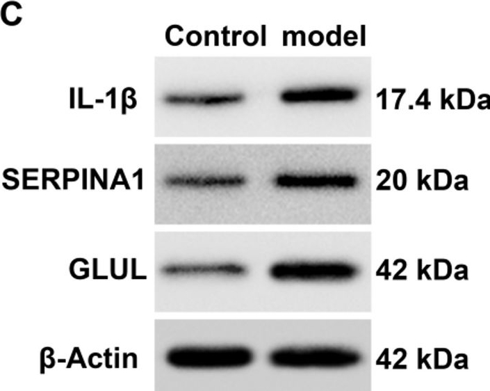 Fig.7.C showing Western Blotting in a Rattus norvegicus (Rat) sample from the publication: Bioinformatics-based study on the regulatory network of lipid metabolism-related genes and mechanisms in coronary heart disease.