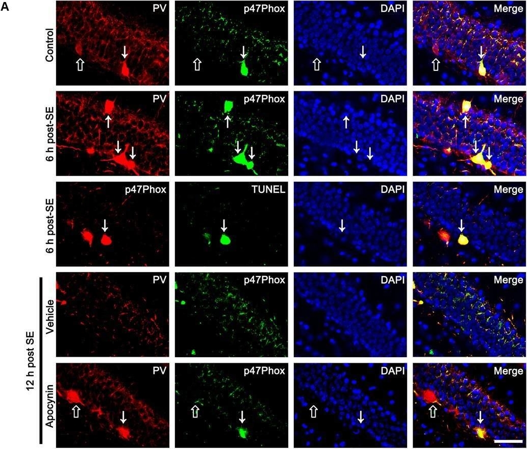 Fig.2.A showing Immunohistochemistry-immunofluorescence in a Rattus norvegicus (Rat) sample from the publication: p47Phox/CDK5/DRP1-Mediated Mitochondrial Fission Evokes PV Cell Degeneration in the Rat Dentate Gyrus Following Status Epilepticus.