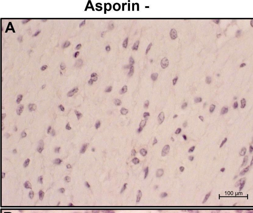 Fig.9.A showing Immunohistochemistry in a Bos taurus (Bovine) sample from the publication: Hyperplastic ovarian stromal cells express genes associated to tumor progression: a case study.
