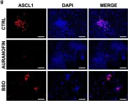 Fig.5.G showing Immunocytochemistry-immunofluorescence from the publication: Ferroptosis response segregates small cell lung cancer (SCLC) neuroendocrine subtypes.