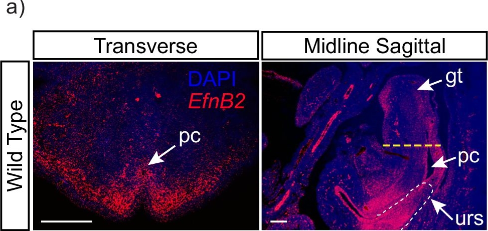 Fig.3.A showing Immunohistochemistry-immunofluorescence from the publication: A long non-coding RNA Leat1 mediates the hormone responsiveness of EfnB2 during male urogenital development.