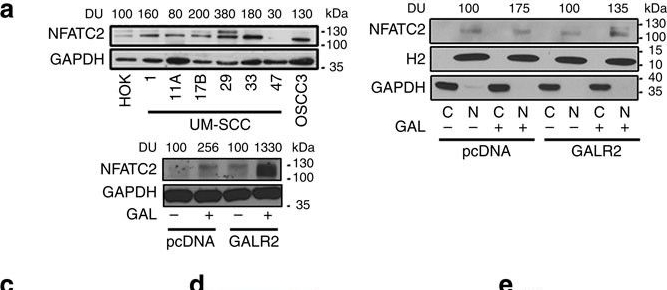 Fig.5.A showing Western Blotting in a Mus musculus (House mouse) sample from the publication: Galanin modulates the neural niche to favour perineural invasion in head and neck cancer.