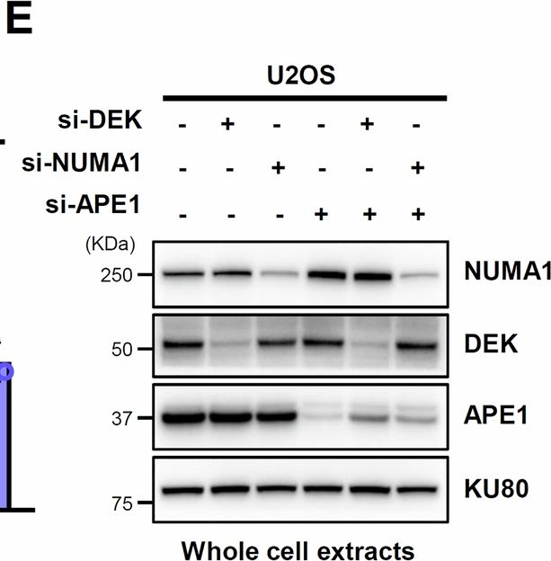 Fig.7.E showing Western Blotting in a Homo sapiens (Human) sample from the publication: Proteomic discovery of DEK and NUMA1 as new players in UV-induced DNA damage repair mechanisms.