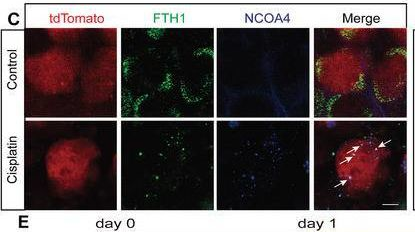 Fig.4.C showing Immunocytochemistry-immunofluorescence from the publication: FOXO1-NCOA4 Axis Contributes to Cisplatin-Induced Cochlea Spiral Ganglion Neuron Ferroptosis via Ferritinophagy.