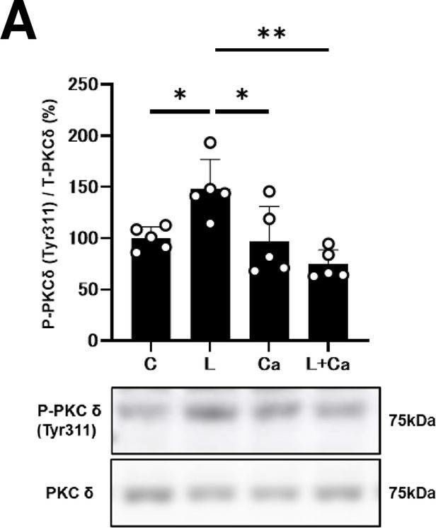 Fig.5.A showing Western Blotting from the publication: Oral angiotensin-converting enzyme inhibitor captopril protects the heart from Porphyromonas gingivalis LPS-induced cardiac dysfunction in mice.