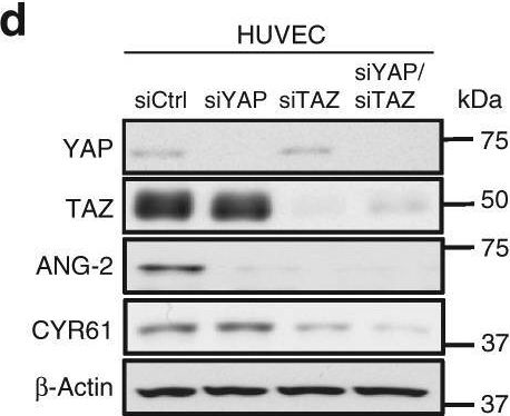 Fig.5.D showing Western Blotting from the publication: A LATS biosensor screen identifies VEGFR as a regulator of the Hippo pathway in angiogenesis.