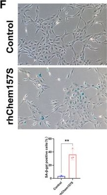Fig.4.F from the publication: Chemerin's Role in Endometrial Dysfunction: Insights From Transcriptomic Analysis.