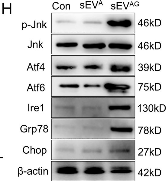 Fig.2.H showing Western Blotting in a Mus musculus (House mouse) sample from the publication: Adipose stem cells-derived small extracellular vesicles transport Thrombospondin 1 cargo to promote insulin resistance in gestational diabetes mellitus.