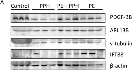Fig.1.A showing Western Blotting in a Homo sapiens (Human) sample from the publication: PDGF-BB as a potential biomarker for early diagnosis of postpartum hemorrhage.
