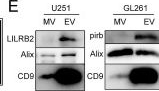 Fig.4.E showing Western Blotting in a Mus musculus (House mouse) sample from the publication: LILRB2-containing small extracellular vesicles from glioblastoma promote tumor progression by promoting the formation and expansion of myeloid-derived suppressor cells.