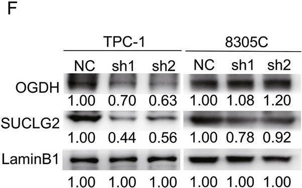 Fig.3.F showing Western Blotting from the publication: CircPSD3 aggravates tumor progression by maintaining TCA cycle and mitochondrial function via regulating SUCLG2 in thyroid carcinoma.
