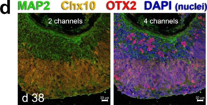 Fig.1.D showing Immunohistochemistry-immunofluorescence in a Rattus norvegicus (Rat) sample from the publication: Retina Organoid Transplants Develop Photoreceptors and Improve Visual Function in RCS Rats With RPE Dysfunction.