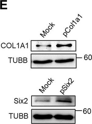 Fig.6.E showing Western Blotting from the publication: High-Intensity Aerobic Exercise Suppresses Cancer Growth by Regulating Skeletal Muscle-Derived Oncogenes and Tumor Suppressors.