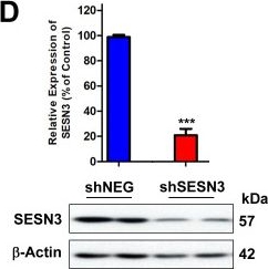 Fig.4.D showing Western Blotting from the publication: Sestrin3 confers resistance to recombinant human arginase in small cell lung cancer by activating Akt/mTOR/ASS1 axis.