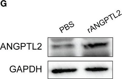 Fig.8.G showing Western Blotting from the publication: ANGPTL2+cancer-associated fibroblasts and SPP1+macrophages are metastasis accelerators of colorectal cancer.