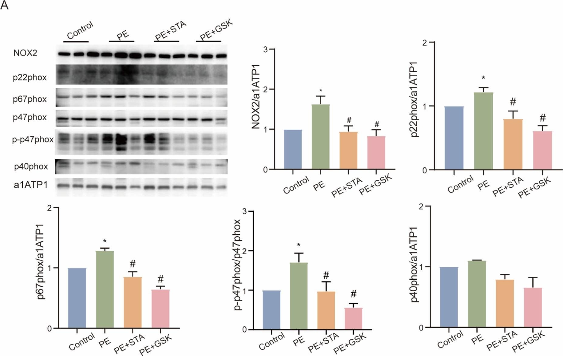Fig.4.A showing Western Blotting from the publication: Stachydrine Hydrochloride Regulates the NOX2-ROS-Signaling Axis in Pressure-Overload-Induced Heart Failure.