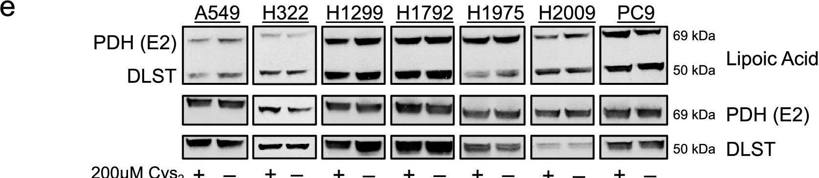 Fig.3.E showing Western Blotting from the publication: Mitochondrial respiratory function is preserved under cysteine starvation via glutathione catabolism in NSCLC.