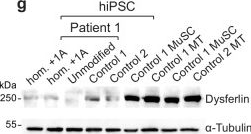 Fig.2.G showing Western Blotting from the publication: Gene-editing in patient and humanized-mice primary muscle stem cells rescues dysferlin expression in dysferlin-deficient muscular dystrophy.